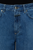 Close up view of zipper of Lyna Jeans - Dark Blue